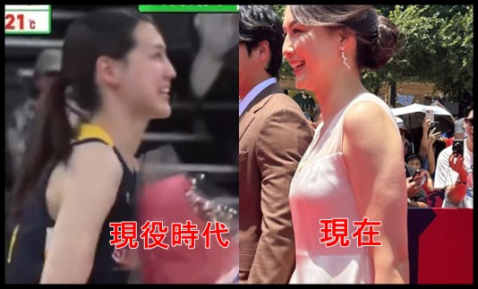 田中真美子夫人の腕を比較２